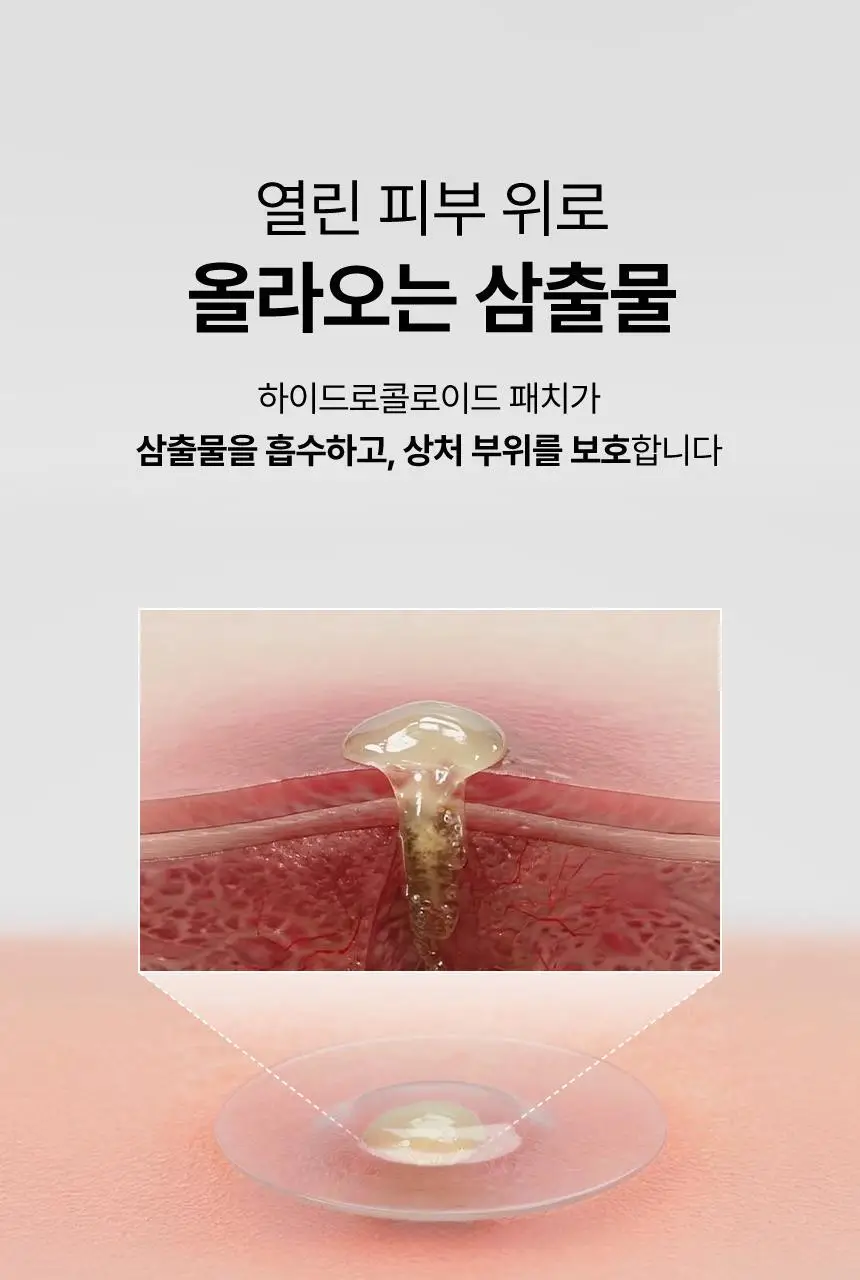 [승헌쓰 PICK] 프란츠 네이키드 스팟 패치 72매입 (얼리, 액티브, 다크) 3종 1 상세페이지 34